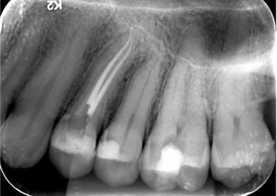 Case Study Images - Guilherme 10-2