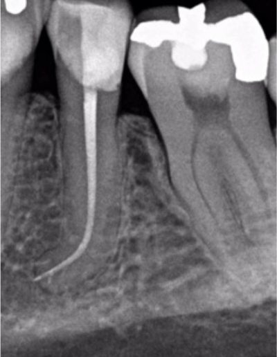 Case Study Images -Hugo 10-2