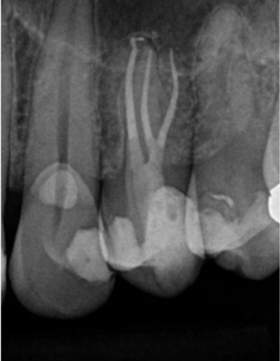 Case Study Images -Hugo 6-3