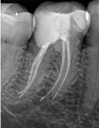 Case Study Images -Hugo 8-2