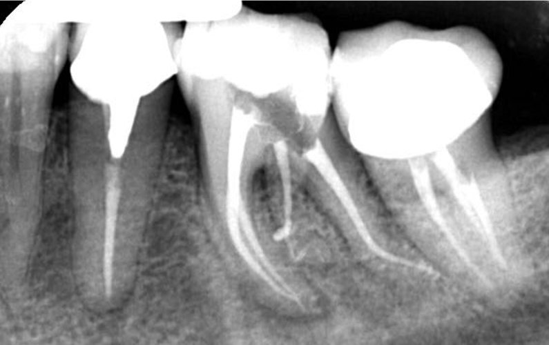 CASE STUDY:  Multiple Curvature 