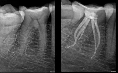 CASE STUDY:  Hugo Bastos Case 2