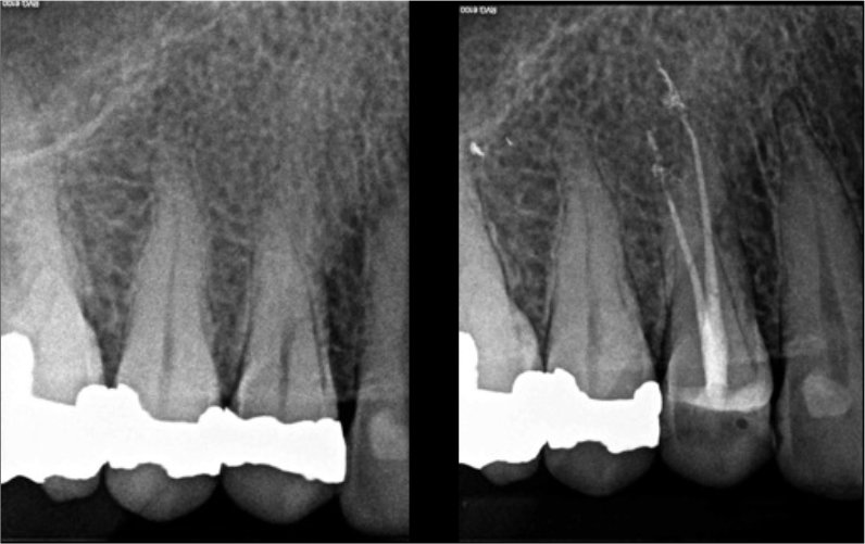 CASE STUDY:  Hugo Bastos Case 4