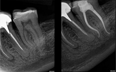 CASE STUDY:  Hugo Bastos Case 5