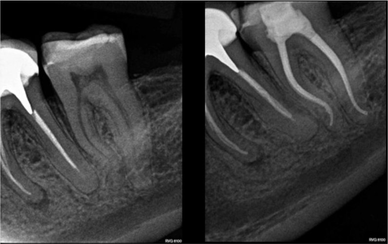 CASE STUDY:  Hugo Bastos Case 5