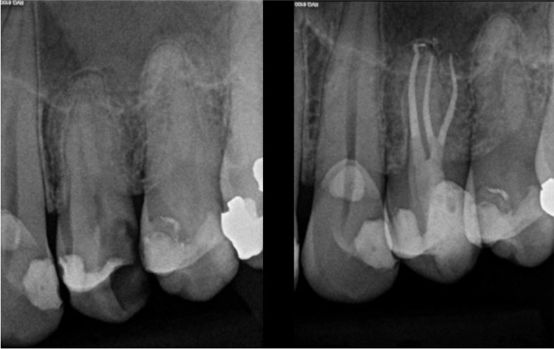 CASE STUDY:  Hugo Bastos Case 6