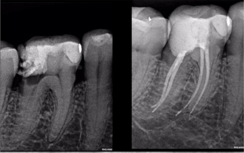 CASE STUDY:  Hugo Bastos Case 8