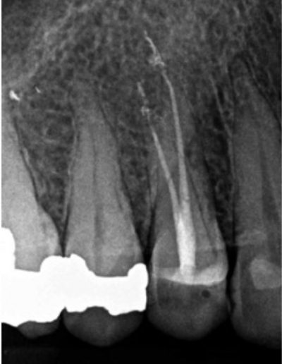 Case-Study-Images-Hugo-4-2-1